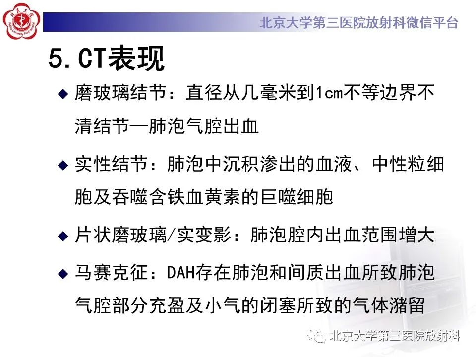 影像PPT - 【PPT】弥漫性肺泡出血-14