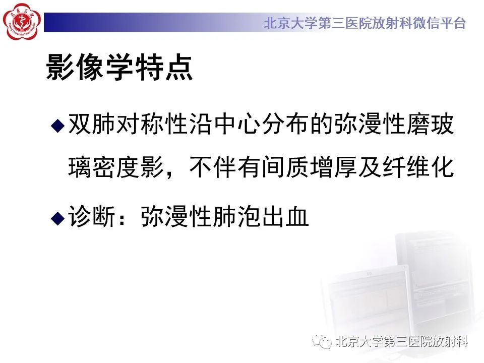 影像PPT - 【PPT】弥漫性肺泡出血-5