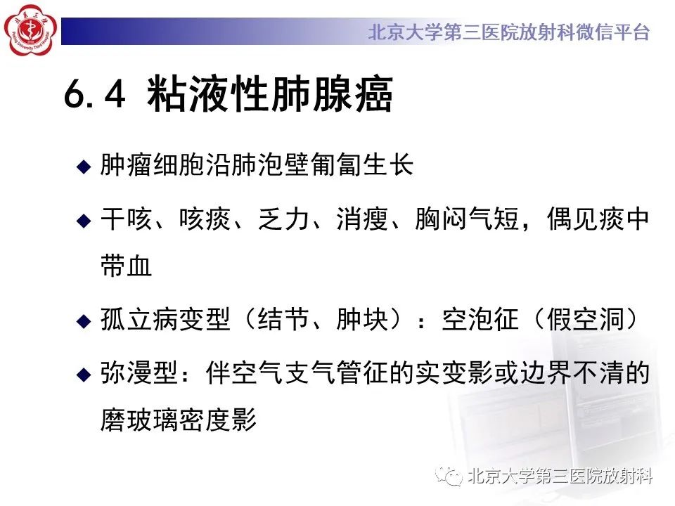 影像PPT - 【PPT】弥漫性肺泡出血-25