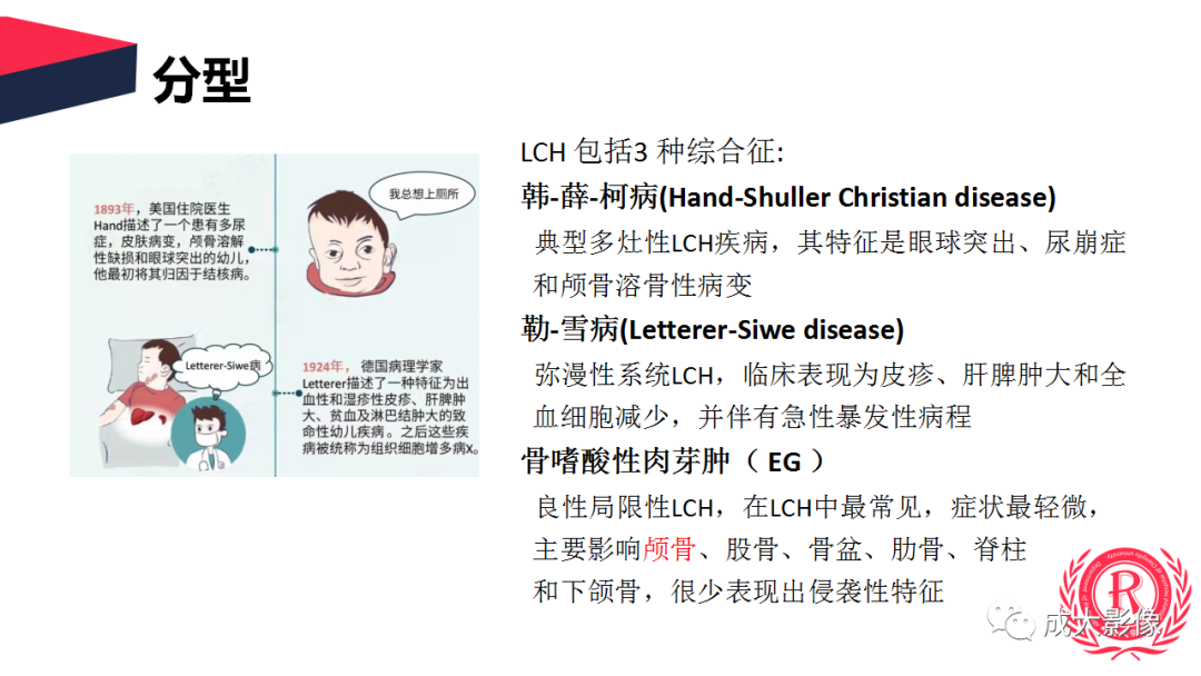 影像PPT - 【PPT】眼眶朗格汉斯细胞组织细胞增生症影像学表现-13 影像PPT - 【PPT】眼眶朗格汉斯细胞组织细胞增生症影像学表现-13