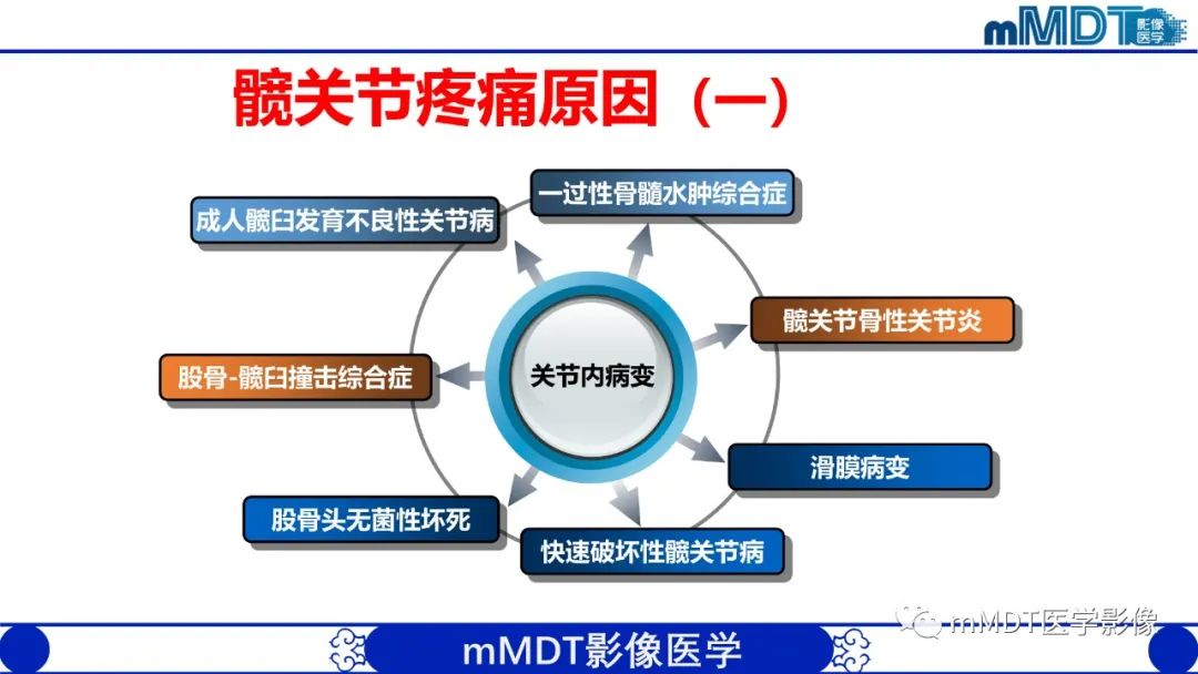 影像PPT - 【PPT】髋关节疼痛临床与影像(一)-4 影像PPT - 【PPT】髋关节疼痛临床与影像(一)-4