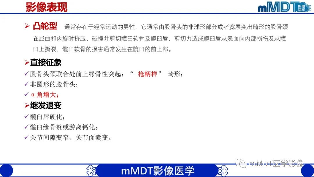 影像PPT - 【PPT】髋关节疼痛临床与影像(一)-17 影像PPT - 【PPT】髋关节疼痛临床与影像(一)-17