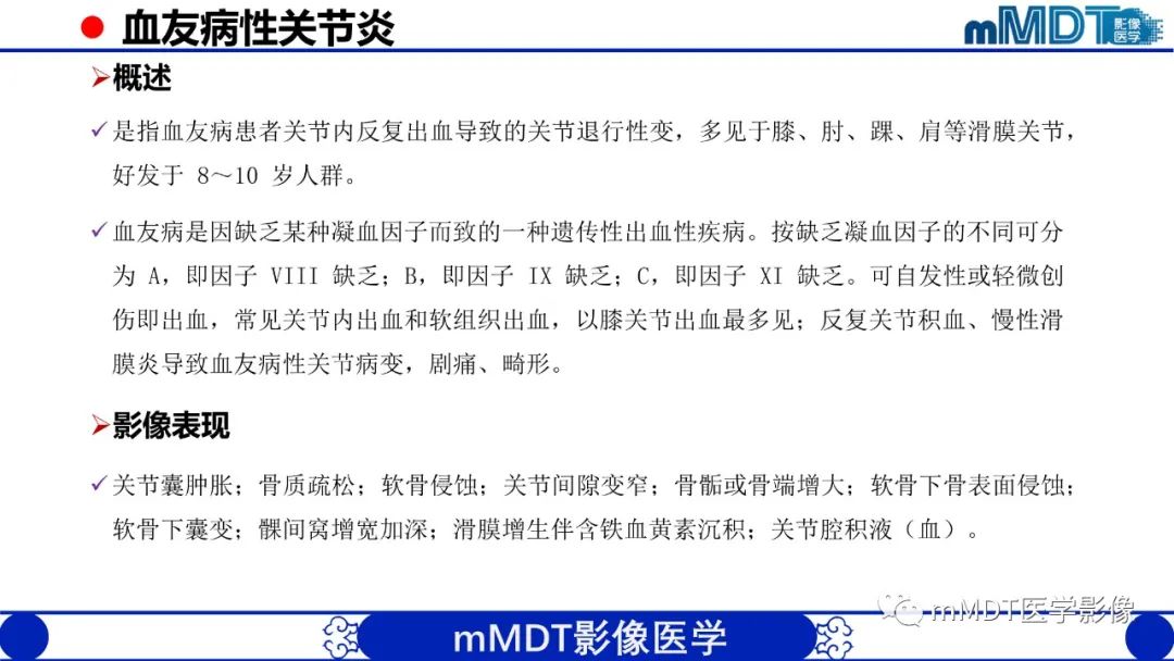 影像PPT - 【PPT】髋关节疼痛临床与影像(一)-50 影像PPT - 【PPT】髋关节疼痛临床与影像(一)-50