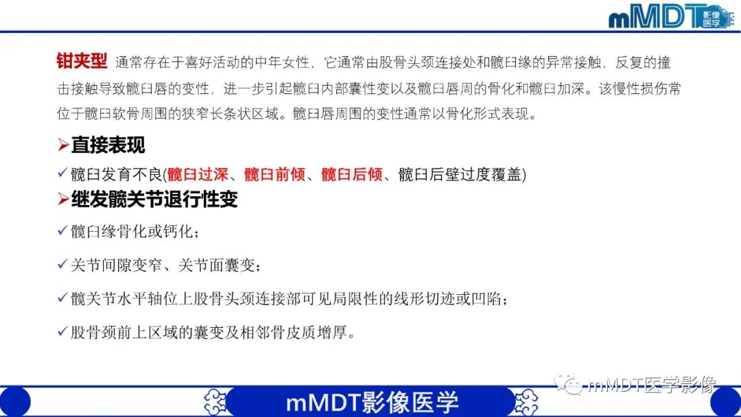 影像PPT - 【PPT】髋关节疼痛临床与影像(一)-20 影像PPT - 【PPT】髋关节疼痛临床与影像(一)-20