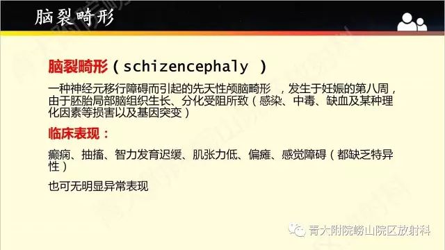 影像PPT - 【PPT】脑裂畸形-2