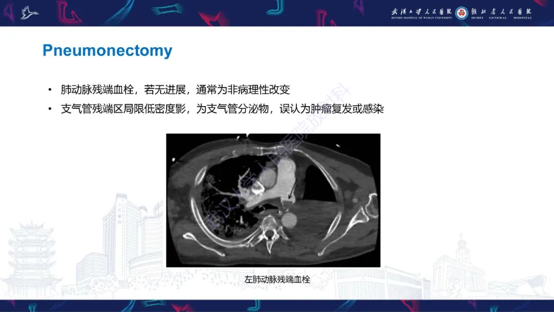 影像PPT - 【PPT】肺癌术后并发症影像诊断-23