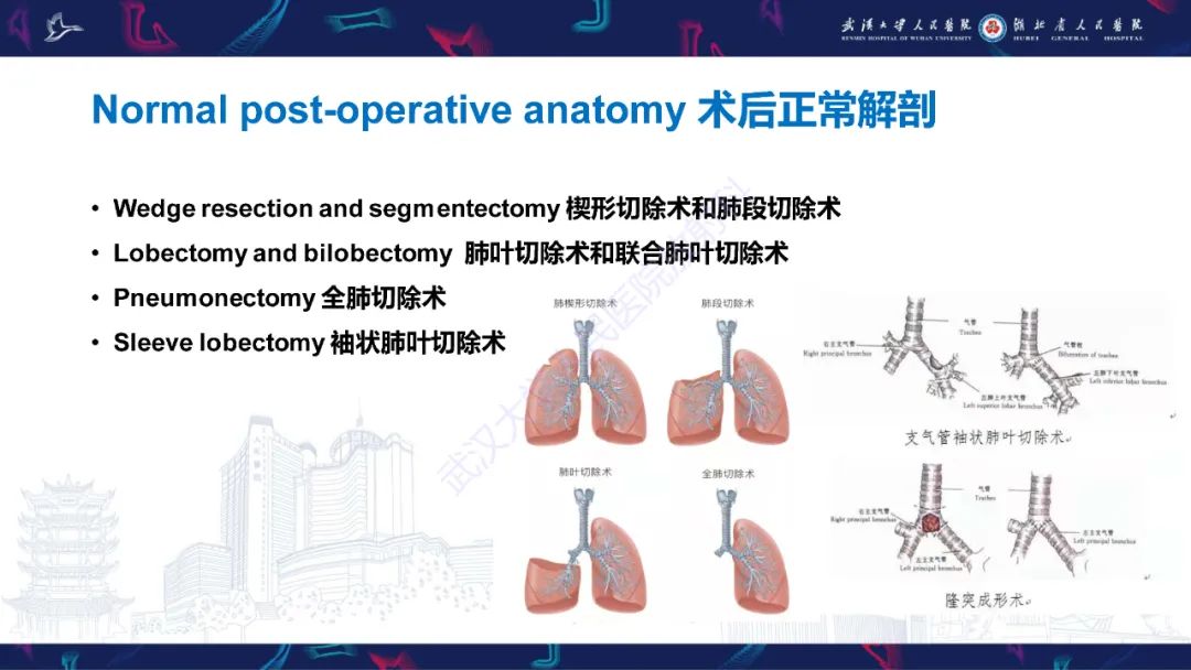 影像PPT - 【PPT】肺癌术后并发症影像诊断-16
