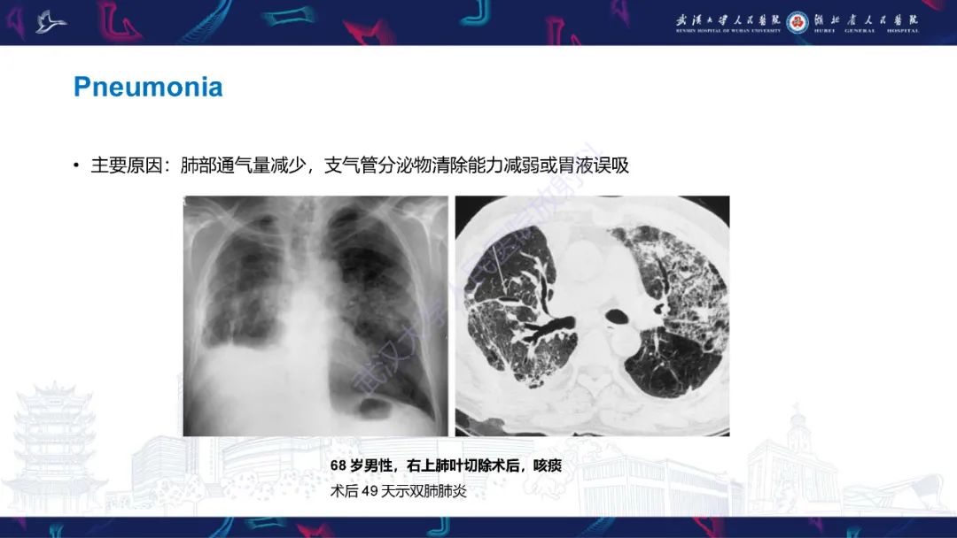 影像PPT - 【PPT】肺癌术后并发症影像诊断-32