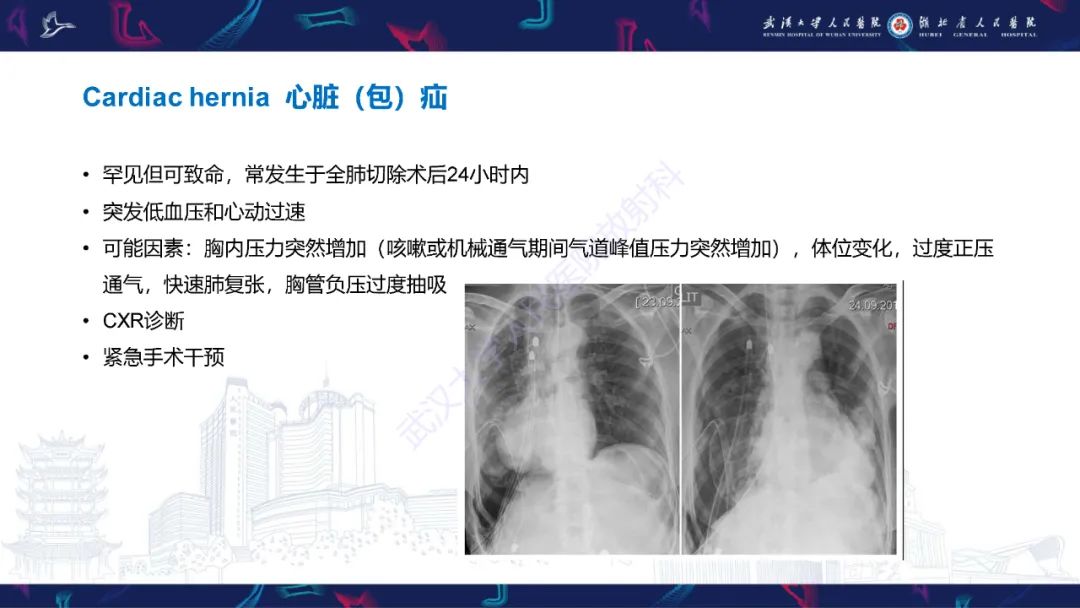 影像PPT - 【PPT】肺癌术后并发症影像诊断-35