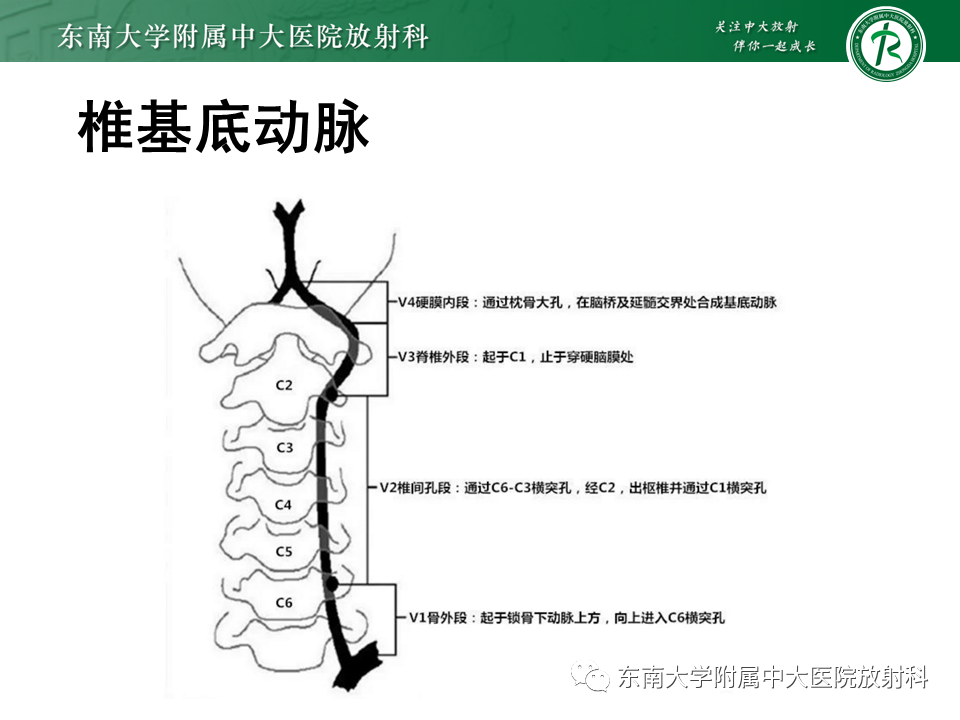影像PPT - 【PPT】颅内外动脉狭窄的VWMRI诊断-5