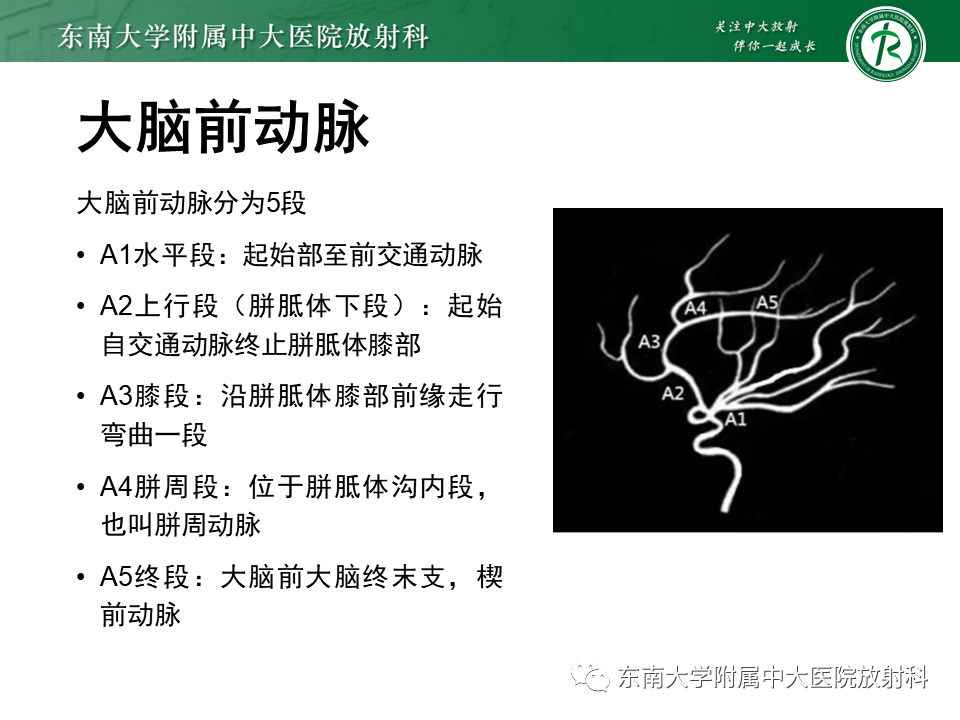 影像PPT - 【PPT】颅内外动脉狭窄的VWMRI诊断-6