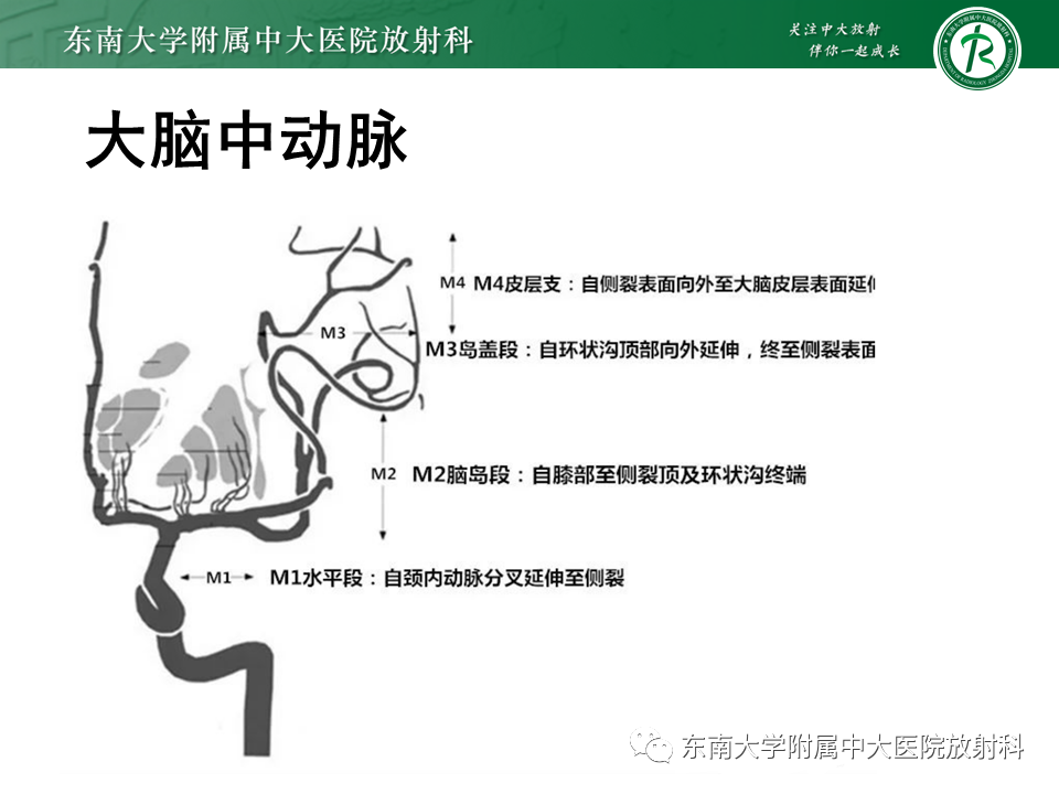 影像PPT - 【PPT】颅内外动脉狭窄的VWMRI诊断-7