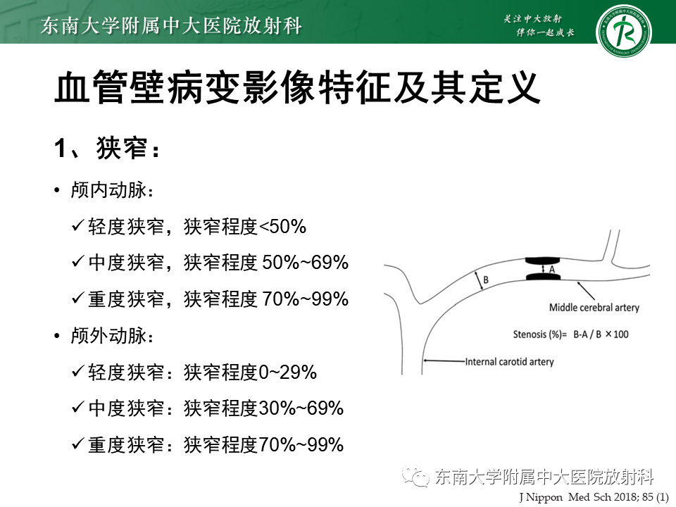 影像PPT - 【PPT】颅内外动脉狭窄的VWMRI诊断-11