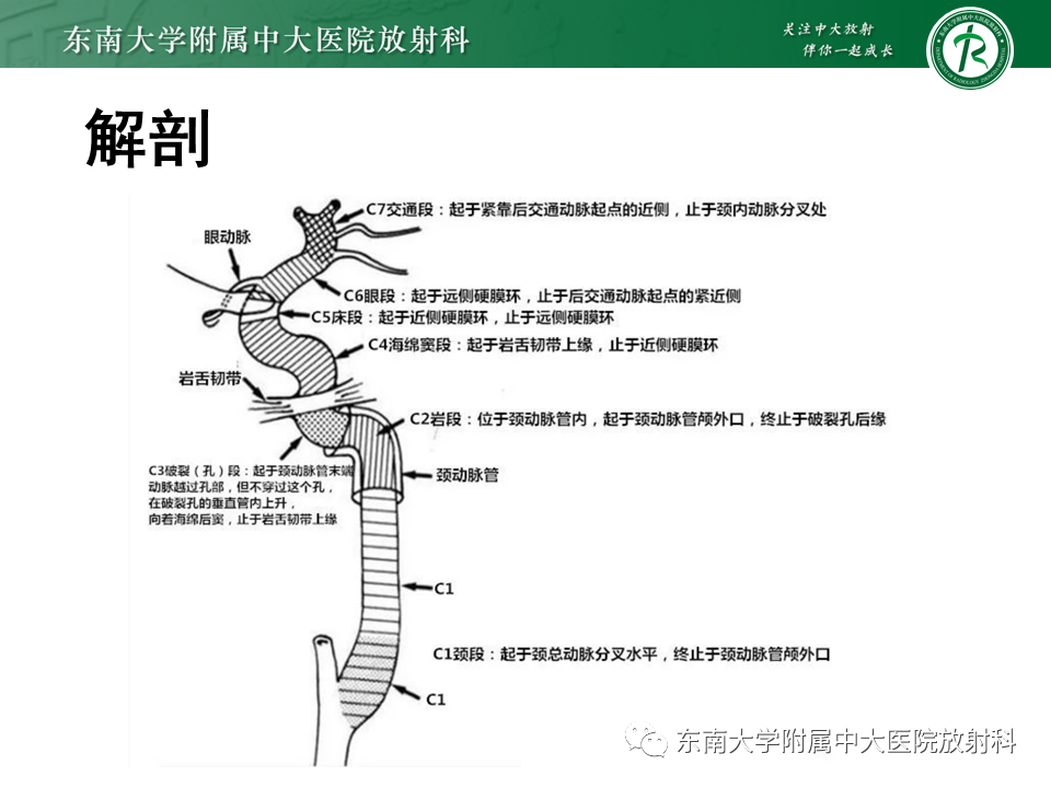 影像PPT - 【PPT】颅内外动脉狭窄的VWMRI诊断-4