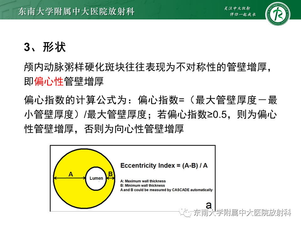 影像PPT - 【PPT】颅内外动脉狭窄的VWMRI诊断-13