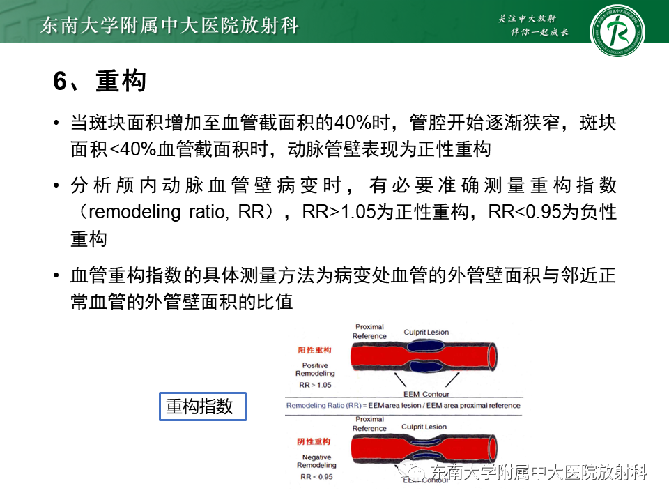 影像PPT - 【PPT】颅内外动脉狭窄的VWMRI诊断-16