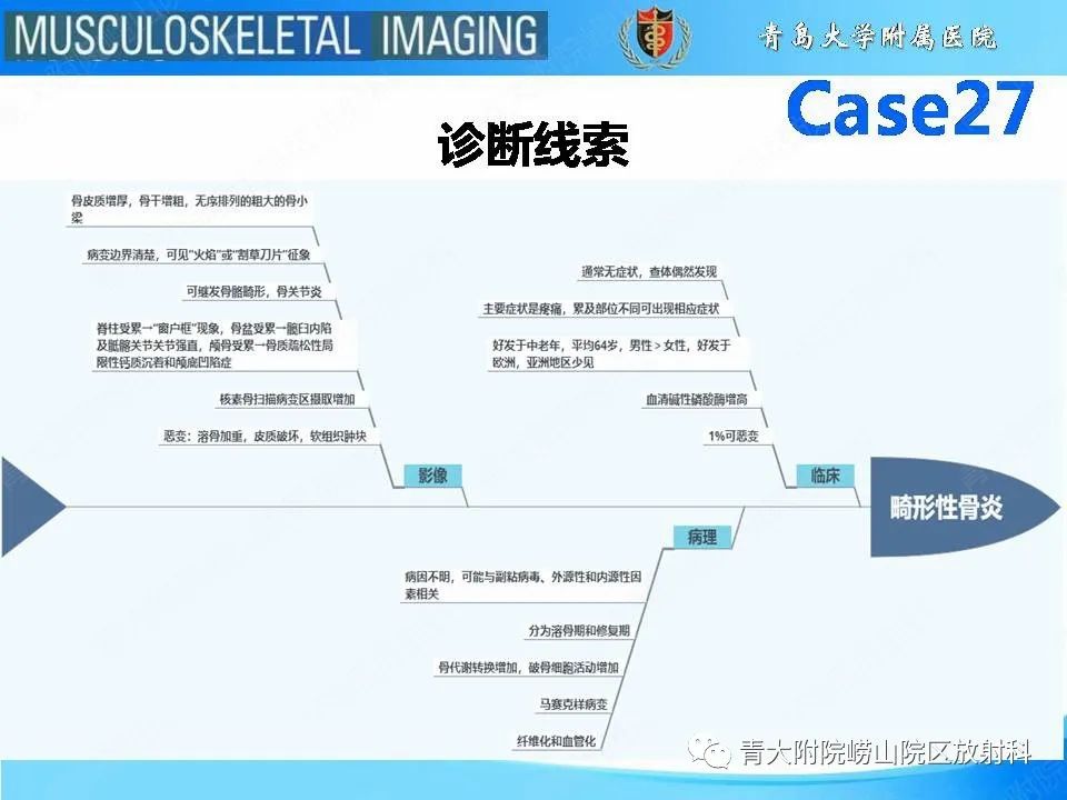 影像PPT - 【PPT】畸形性骨炎-24