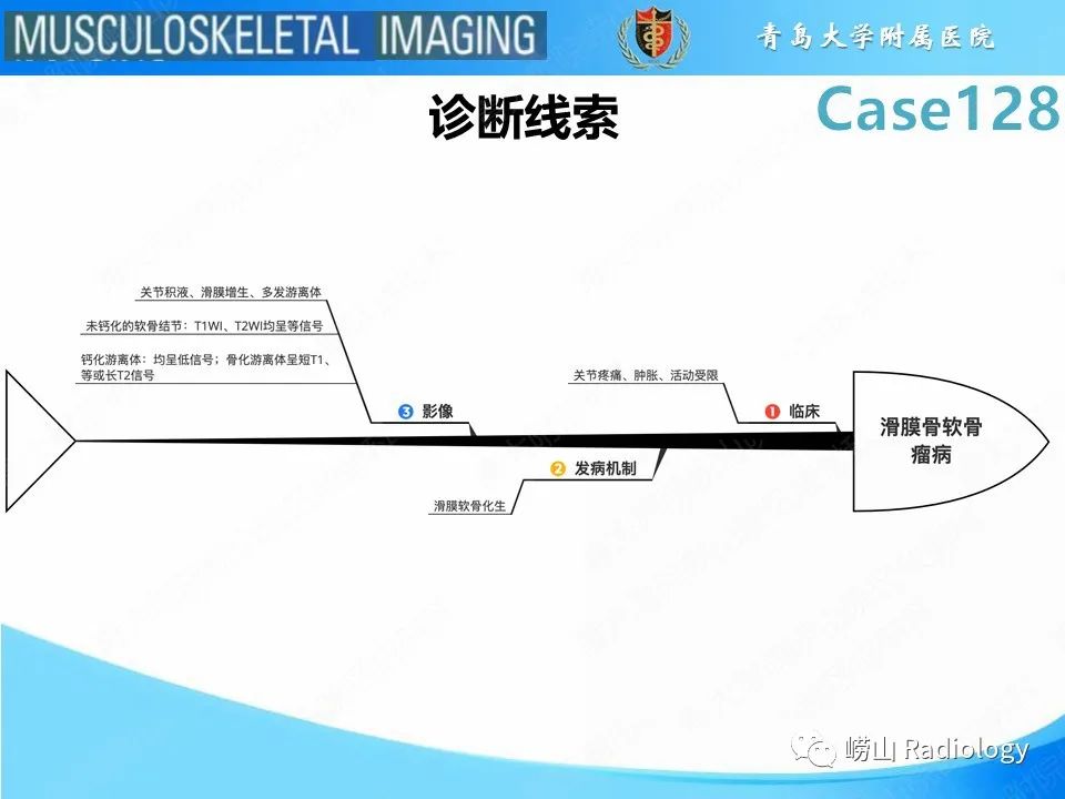 影像PPT - 【PPT】滑膜骨软骨瘤病-22