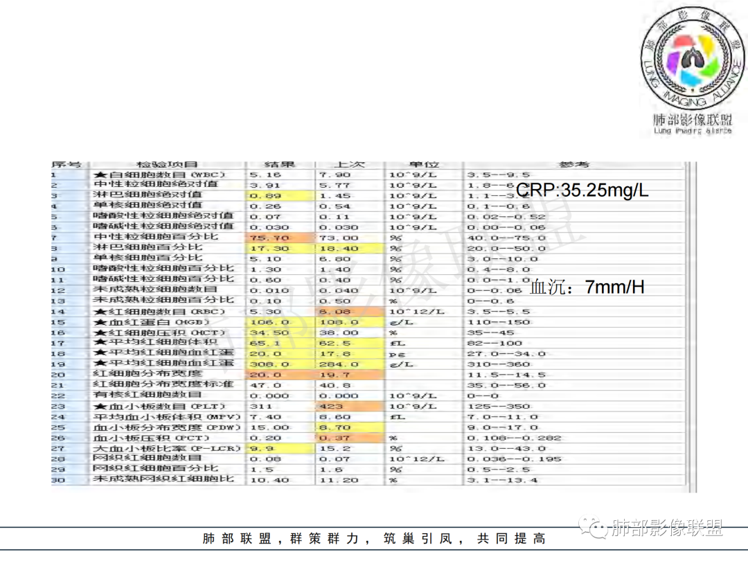 影像PPT - 【病例】年龄与环形强化可大致锁定病原体-4 影像PPT - 【病例】年龄与环形强化可大致锁定病原体-4