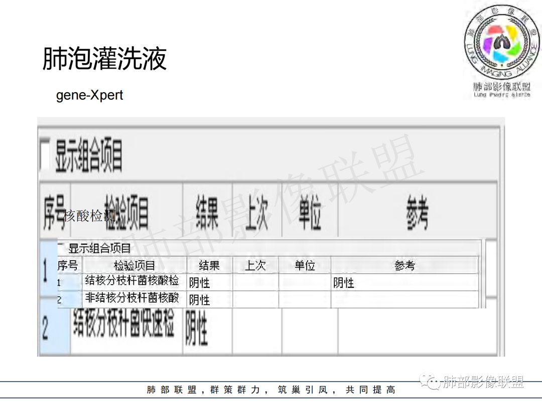 影像PPT - 【病例】年龄与环形强化可大致锁定病原体-3 影像PPT - 【病例】年龄与环形强化可大致锁定病原体-3