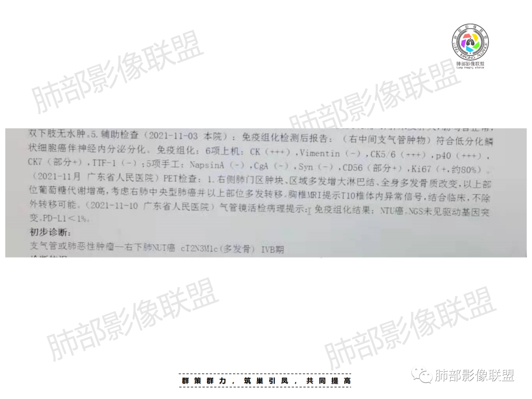 影像PPT - 【病例】 认识罕见的肺NUT癌-50 影像PPT - 【病例】 认识罕见的肺NUT癌-50