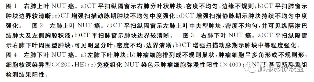 影像PPT - 【病例】 认识罕见的肺NUT癌-54 影像PPT - 【病例】 认识罕见的肺NUT癌-54
