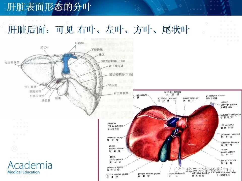 影像PPT - 【PPT】肝脏的基本解剖与分段-13