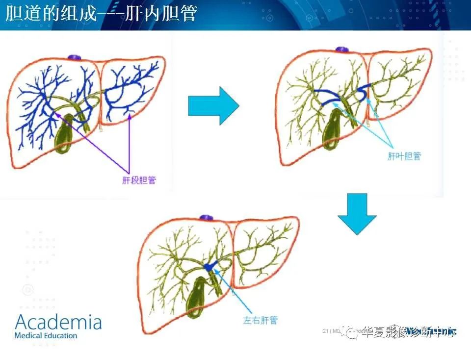影像PPT - 【PPT】肝脏的基本解剖与分段-21