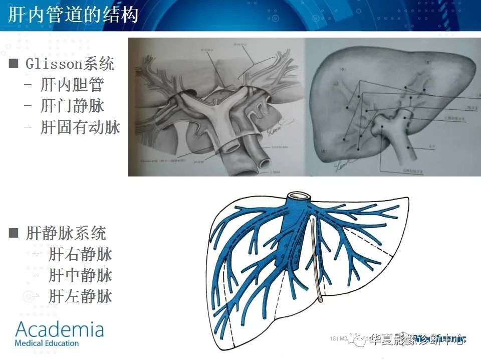 影像PPT - 【PPT】肝脏的基本解剖与分段-16