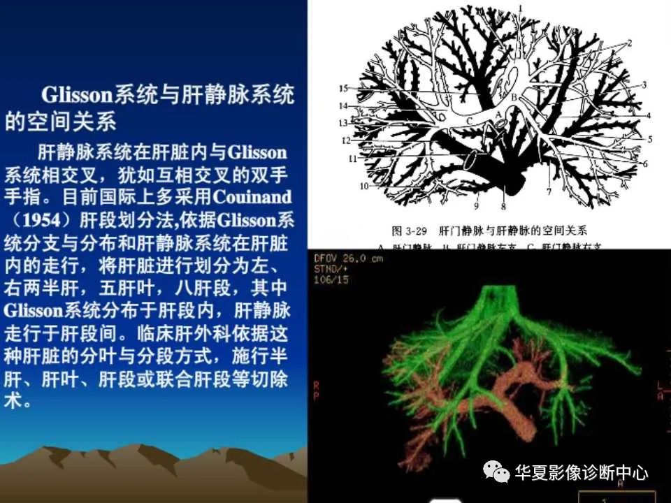 影像PPT - 【PPT】肝脏的基本解剖与分段-17