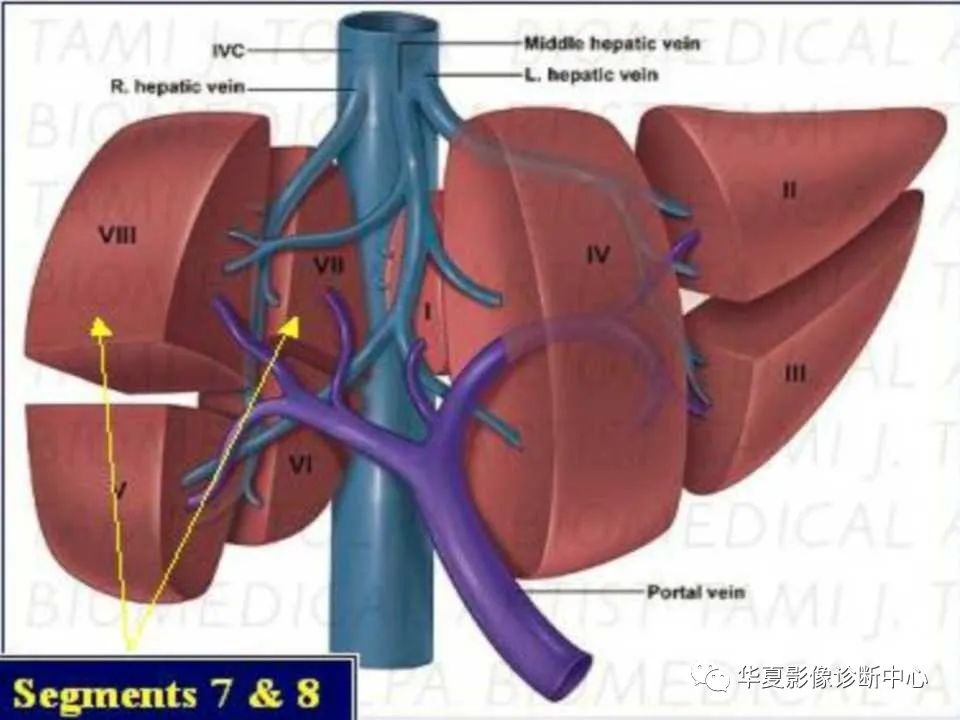 影像PPT - 【PPT】肝脏的基本解剖与分段-31