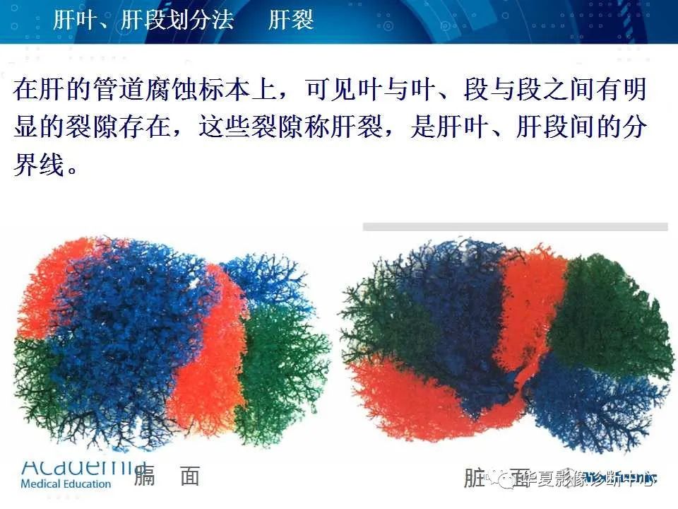 影像PPT - 【PPT】肝脏的基本解剖与分段-32