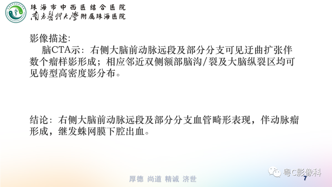 影像PPT - 【PPT】蛛网膜下腔出血-7