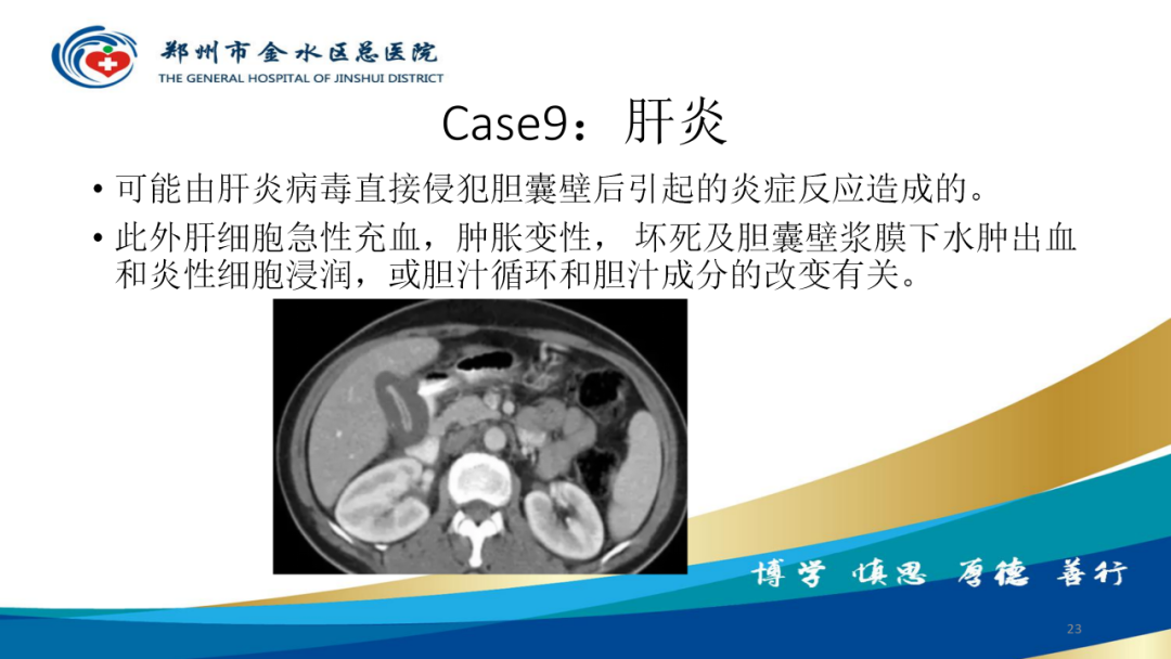影像PPT - 【PPT】胆囊增厚的常见疾病-23