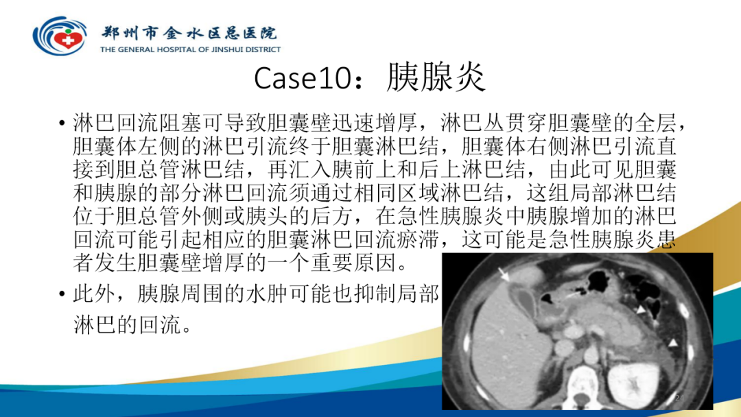 影像PPT - 【PPT】胆囊增厚的常见疾病-24