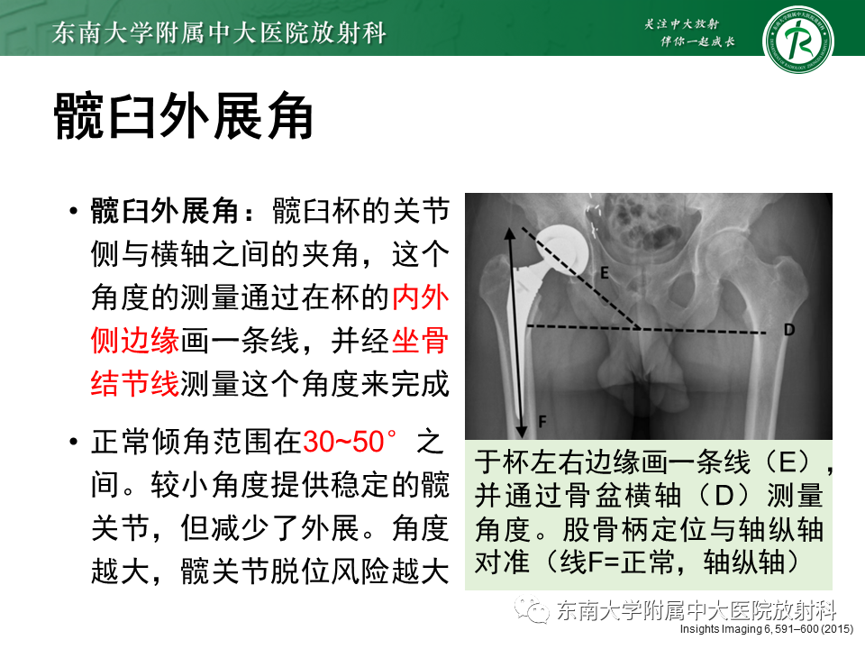 影像PPT - 【PPT】髋关节置换术后影像学评估-15 影像PPT - 【PPT】髋关节置换术后影像学评估-15