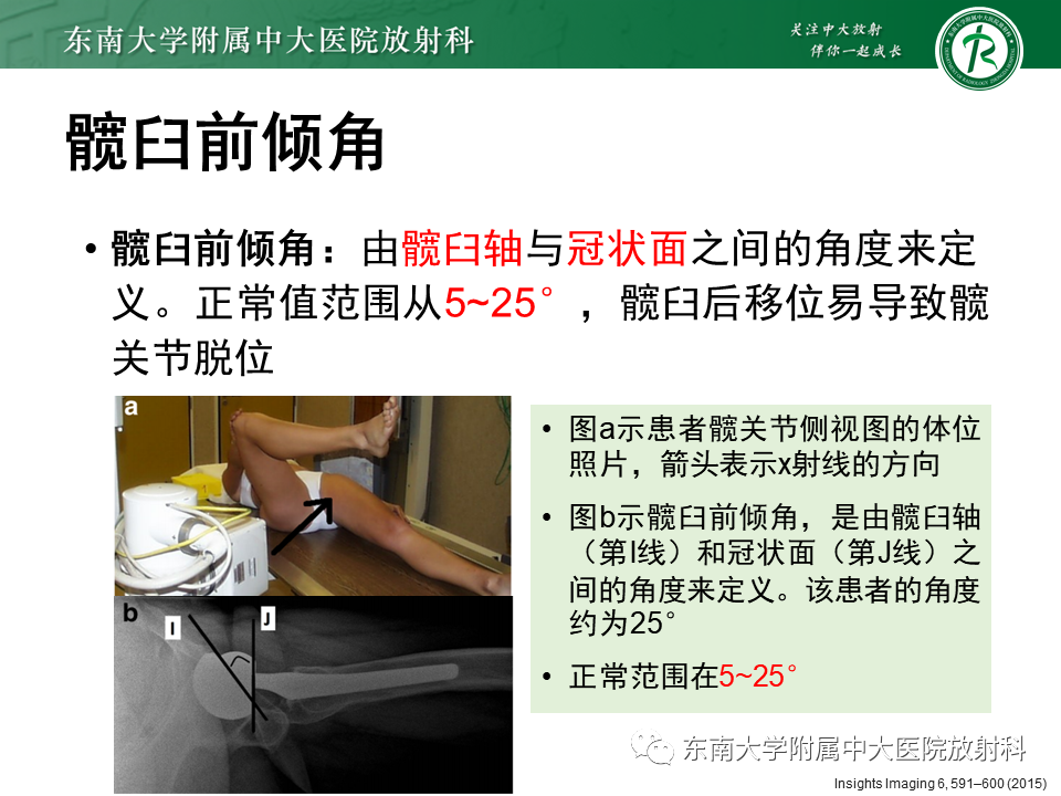 影像PPT - 【PPT】髋关节置换术后影像学评估-17 影像PPT - 【PPT】髋关节置换术后影像学评估-17
