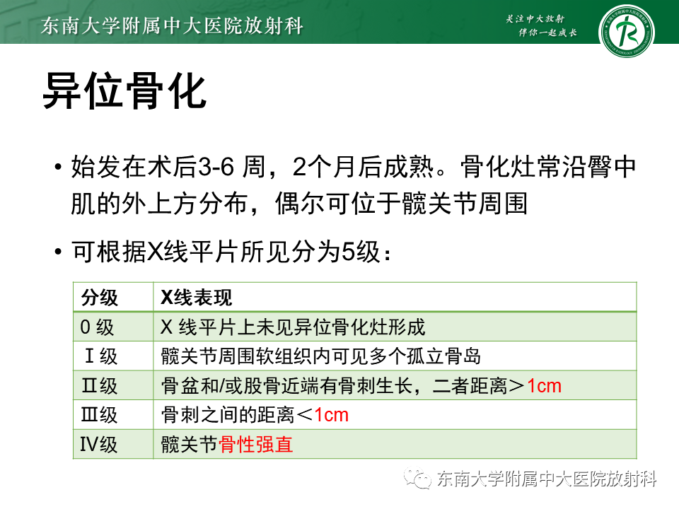 影像PPT - 【PPT】髋关节置换术后影像学评估-30 影像PPT - 【PPT】髋关节置换术后影像学评估-30