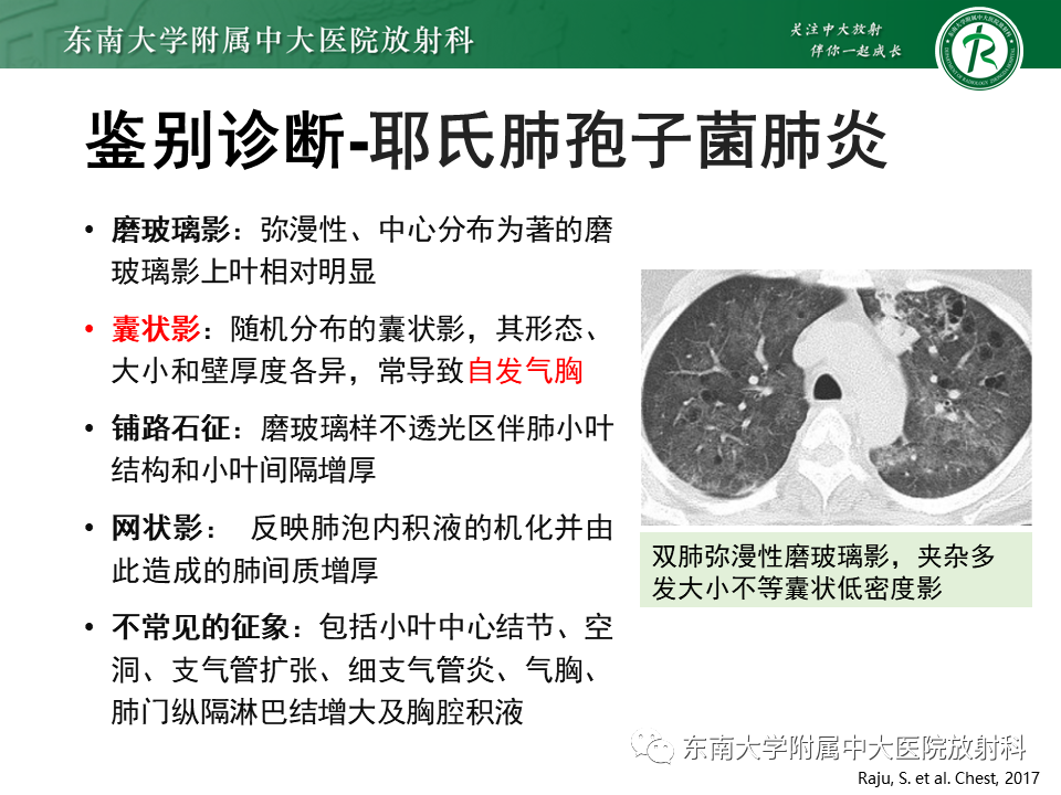 影像PPT - 【PPT】肺泡蛋白沉积症(PAP)-15