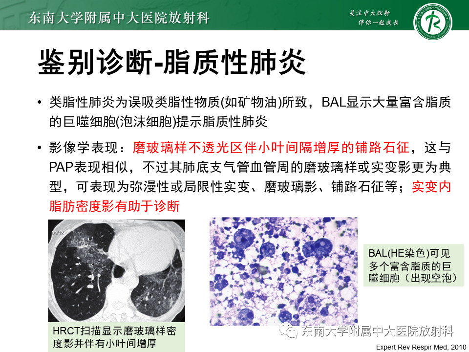 影像PPT - 【PPT】肺泡蛋白沉积症(PAP)-18