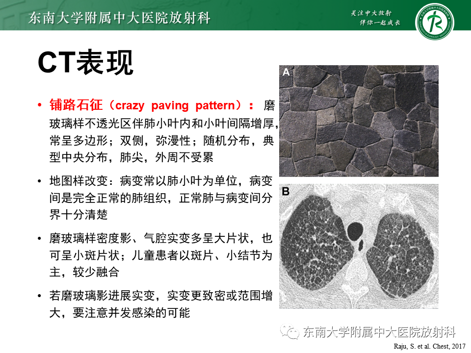影像PPT - 【PPT】肺泡蛋白沉积症(PAP)-8