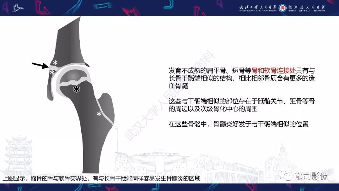 影像PPT - 【PPT】婴幼儿血源性骨髓炎-6