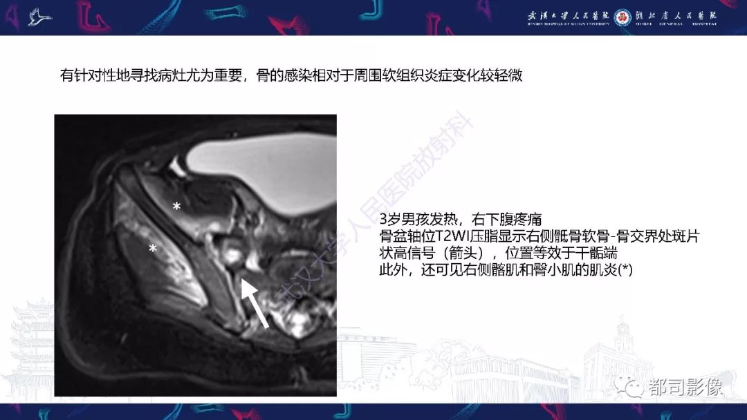 影像PPT - 【PPT】婴幼儿血源性骨髓炎-7