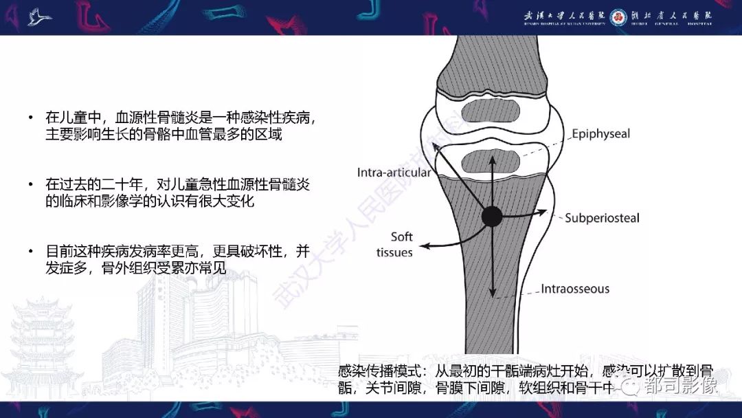 影像PPT - 【PPT】婴幼儿血源性骨髓炎-2