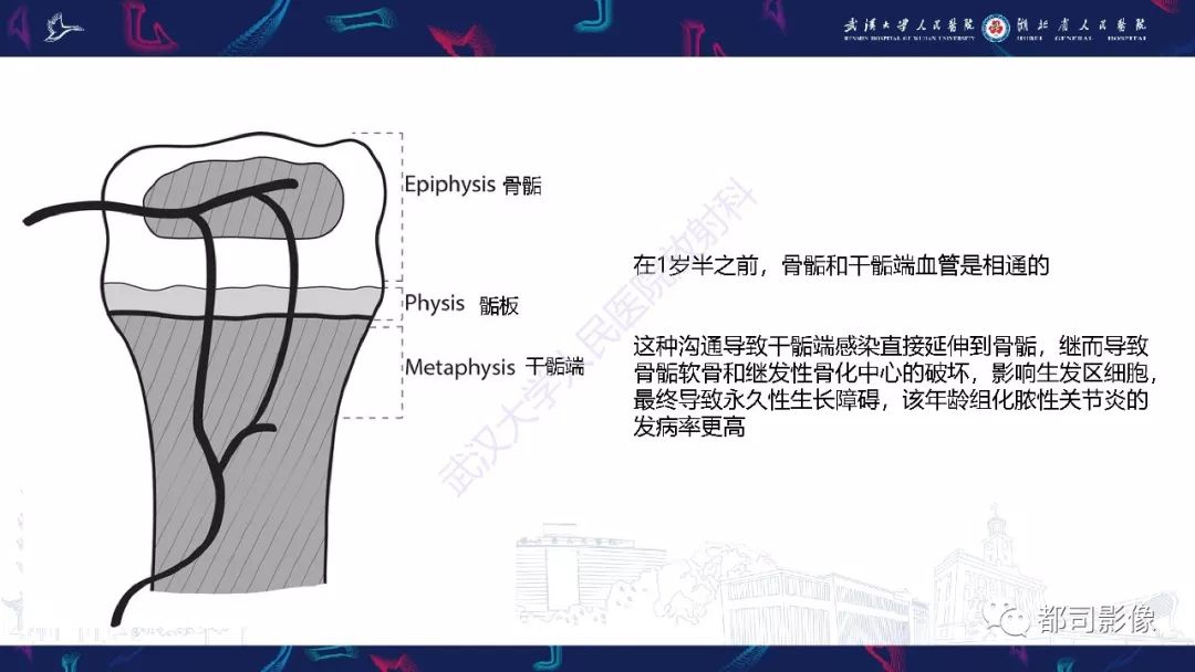 影像PPT - 【PPT】婴幼儿血源性骨髓炎-5