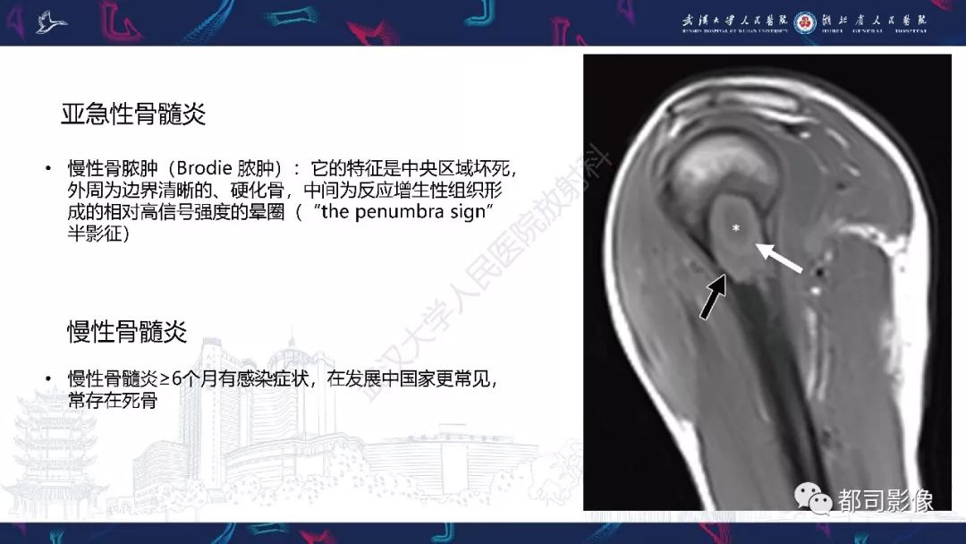 影像PPT - 【PPT】婴幼儿血源性骨髓炎-31