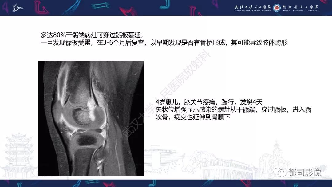 影像PPT - 【PPT】婴幼儿血源性骨髓炎-27