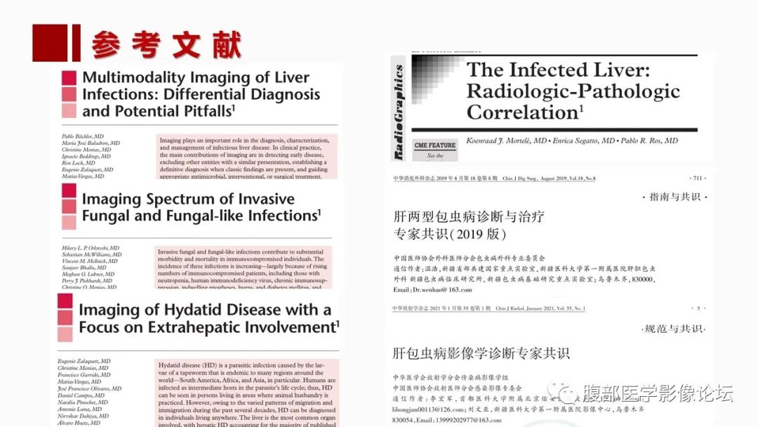 影像PPT - 【PPT】肝脏感染性疾病的多模态影像诊断及鉴别-2