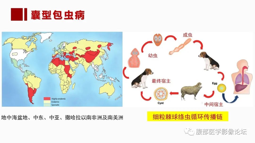 影像PPT - 【PPT】肝脏感染性疾病的多模态影像诊断及鉴别-50