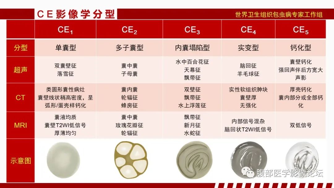 影像PPT - 【PPT】肝脏感染性疾病的多模态影像诊断及鉴别-52
